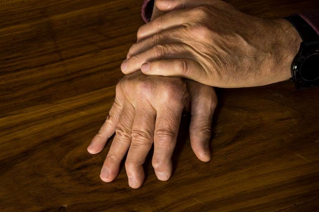 CBD Oil for Psoriatic Arthritis – How Does Cannabidiol Work?, #1 USA Cannabidiol Blog CBD Oil for Psoriatic Arthritis, CBD Oil for Psoriatic Arthritis – How Does Cannabidiol Work?, #1 USA Cannabidiol Blog